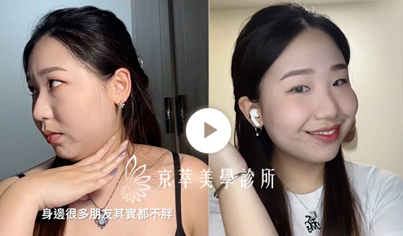 我不是胖，但就是有雙下巴